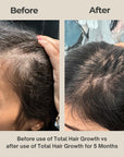 Total Hair Growth