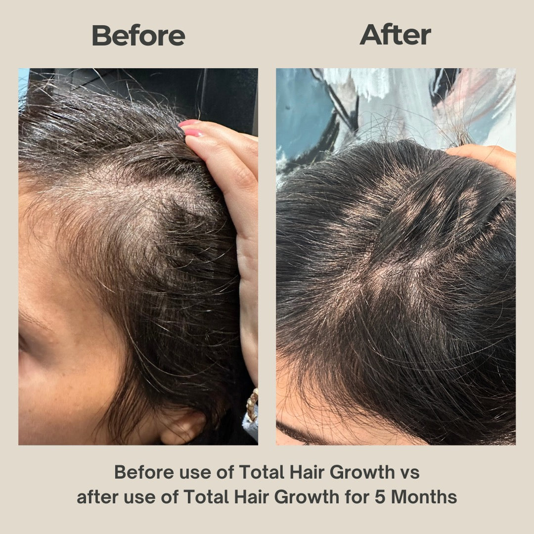 Total Hair Growth